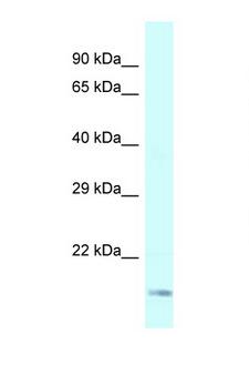 GEMIN6 / Gemin-6 Antibody - GEMIN6 antibody Western blot of Fetal Lung lysate. Antibody concentration 1 ug/ml.  This image was taken for the unconjugated form of this product. Other forms have not been tested.