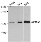GEMIN6 / Gemin-6 Antibody - Western blot analysis of extracts of various cell lines, using GEMIN6 antibody at 1:3000 dilution. The secondary antibody used was an HRP Goat Anti-Rabbit IgG (H+L) at 1:10000 dilution. Lysates were loaded 25ug per lane and 3% nonfat dry milk in TBST was used for blocking. An ECL Kit was used for detection and the exposure time was 90s.
