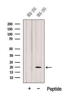 GEMIN6 / Gemin-6 Antibody - Western blot analysis of extracts of HEK293 cells using GEMIN6 antibody. The lane on the left was treated with blocking peptide.