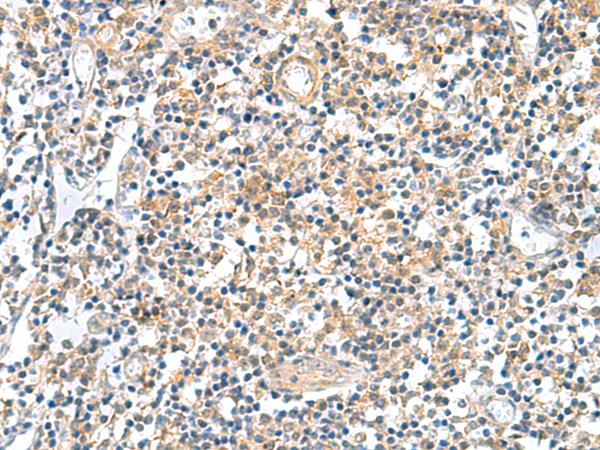 GEMIN7 Antibody - Immunohistochemistry of paraffin-embedded Human tonsil tissue  using GEMIN7 Polyclonal Antibody at dilution of 1:50(×200)