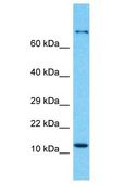 GEMIN7 Antibody - GEMIN7 antibody Western Blot of MCF7. Antibody dilution: 1 ug/ml.  This image was taken for the unconjugated form of this product. Other forms have not been tested.