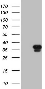 GEMIN8 Antibody - HEK293T cells were transfected with the pCMV6-ENTRY control. (Left lane) or pCMV6-ENTRY GEMIN8. (Right lane) cDNA for 48 hrs and lysed. Equivalent amounts of cell lysates. (5 ug per lane) were separated by SDS-PAGE and immunoblotted with anti-GEMIN8.