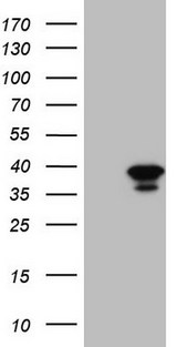 GEMIN8 Antibody - HEK293T cells were transfected with the pCMV6-ENTRY control. (Left lane) or pCMV6-ENTRY GEMIN8. (Right lane) cDNA for 48 hrs and lysed. Equivalent amounts of cell lysates. (5 ug per lane) were separated by SDS-PAGE and immunoblotted with anti-GEMIN8.