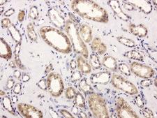 GEMIN8 Antibody - Immunohistochemical staining of paraffin-embedded human kidney using anti- GEMIN8 clone UMAB185 mouse monoclonal antibody at 1:400 dilution of 1.0 mg/mL using Polink2 Broad HRP DAB for detection.requires HIER with with Accel 3in1 EDTA solution ph8.7 at 110C for 3 min using pressure chamber/cooker. The tubule epithelia cells shows strong membraneous and cytoplasmic staining.
