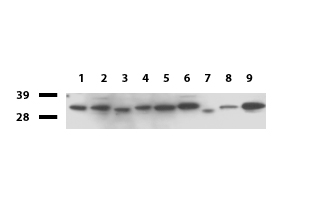 GEMIN8 Antibody - Western blot of cell lysates. (35ug) from 9 different cell lines. (1: HepG2, 2: HeLa, 3: SV-T2, 4: A549, 5: COS7, 6: Jurkat, 7: MDCK, 8: PC-12, 9: MCF7). Diluation: 1:500