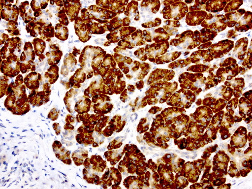 GEMIN8 Antibody - Immunohistochemical staining of paraffin-embedded human pancreas using anti- GEMIN8 clone UMAB185 mouse monoclonal antibody at 1:400 dilution of 1.0 mg/mL using Polink2 Broad HRP DAB for detection.requires HIER with with Accel 3in1 EDTA solution ph8.7 at 110C for 3 min using pressure chamber/cooker. The shows strong membraneous and cytoplasmic staining in exocrin cells.