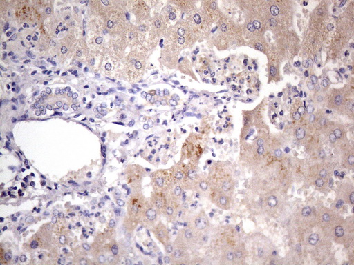 GEMIN8 Antibody - Immunohistochemical staining of paraffin-embedded Human liver tissue using anti-GEMIN8 mouse monoclonal antibody. (Heat-induced epitope retrieval by 1mM EDTA in 10mM Tris buffer. (pH8.0) at 110C for 10 min. (1:400)