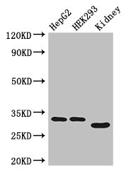 GEMIN8 Antibody - Western Blot Positive WB detected in: HepG2 whole cell lysate, HEK293 whole cell lysate, Mouse kidney tissue All lanes: GEMIN8 antibody at 4µg/ml Secondary Goat polyclonal to rabbit IgG at 1/50000 dilution Predicted band size: 29 kDa Observed band size: 29, 33 kDa
