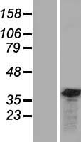 GEMIN8 Protein - Western validation with an anti-DDK antibody * L: Control HEK293 lysate R: Over-expression lysate