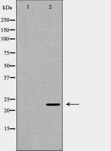 Geminin Antibody - Western blot analysis of HEK293 whole cell lysates using GMNN antibody. The lane on the left is treated with the antigen-specific peptide.