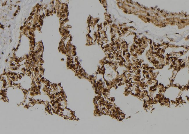 Geminin Antibody - 1:100 staining rat lung tissue by IHC-P. The sample was formaldehyde fixed and a heat mediated antigen retrieval step in citrate buffer was performed. The sample was then blocked and incubated with the antibody for 1.5 hours at 22°C. An HRP conjugated goat anti-rabbit antibody was used as the secondary.