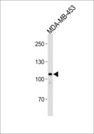 GEN1 Antibody - Western blot of lysate from MDA-MB-453 cell line, using GEN1 Antibody. Antibody was diluted at 1:1000. A goat anti-rabbit IgG H&L (HRP) at 1:5000 dilution was used as the secondary antibody. Lysate at 35ug.