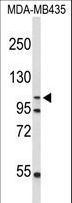 GEN1 Antibody - Western blot of GEN1 Antibody in MDA-MB435 cell line lysates (35 ug/lane). GEN1 (arrow) was detected using the purified antibody;