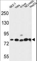 Gephyrin Antibody - GPHN Antibody western blot of MCF-7,HeLa,NCI-H460,HepG2 cell line and mouse liver tissue lysates (35 ug/lane). The GPHN antibody detected the GPHN protein (arrow).