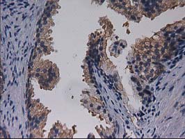 Gephyrin Antibody - IHC of paraffin-embedded Human prostate tissue using anti-GPHN mouse monoclonal antibody.