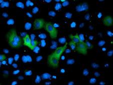 Gephyrin Antibody - Anti-GPHN mouse monoclonal antibody immunofluorescent staining of COS7 cells transiently transfected by pCMV6-ENTRY GPHN.