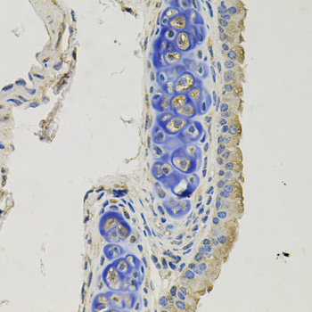 Gephyrin Antibody - Immunohistochemistry of paraffin-embedded mouse lung tissue.