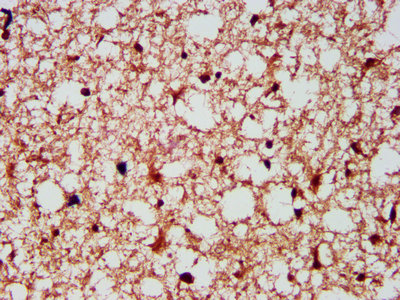 Gephyrin Antibody - Immunohistochemistry Dilution at 1:300 and staining in paraffin-embedded human brain tissue performed on a Leica BondTM system. After dewaxing and hydration, antigen retrieval was mediated by high pressure in a citrate buffer (pH 6.0). Section was blocked with 10% normal Goat serum 30min at RT. Then primary antibody (1% BSA) was incubated at 4°C overnight. The primary is detected by a biotinylated Secondary antibody and visualized using an HRP conjugated SP system.