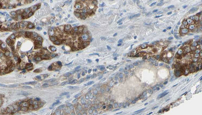 Gephyrin Antibody - 1:100 staining human prostate tissue by IHC-P. The sample was formaldehyde fixed and a heat mediated antigen retrieval step in citrate buffer was performed. The sample was then blocked and incubated with the antibody for 1.5 hours at 22°C. An HRP conjugated goat anti-rabbit antibody was used as the secondary.