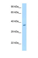 GET4 Antibody - GET4 antibody Western blot of MCF7 Cell lysate. Antibody concentration 1 ug/ml.  This image was taken for the unconjugated form of this product. Other forms have not been tested.