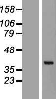 GET4 Protein - Western validation with an anti-DDK antibody * L: Control HEK293 lysate R: Over-expression lysate