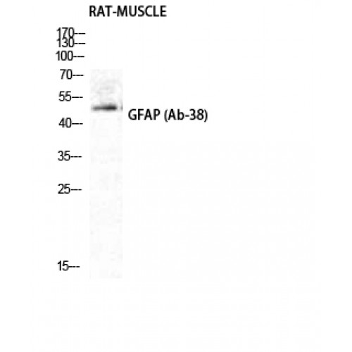 GFAP Antibody - Western blot of GFAP antibody