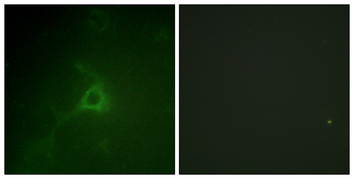GFAP Antibody - Immunofluorescence analysis of COS7 cells, using GFAP Antibody. The picture on the right is blocked with the synthesized peptide.