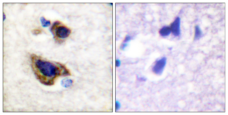 GFAP Antibody - Immunohistochemistry analysis of paraffin-embedded human brain tissue, using GFAP Antibody. The picture on the right is blocked with the synthesized peptide.