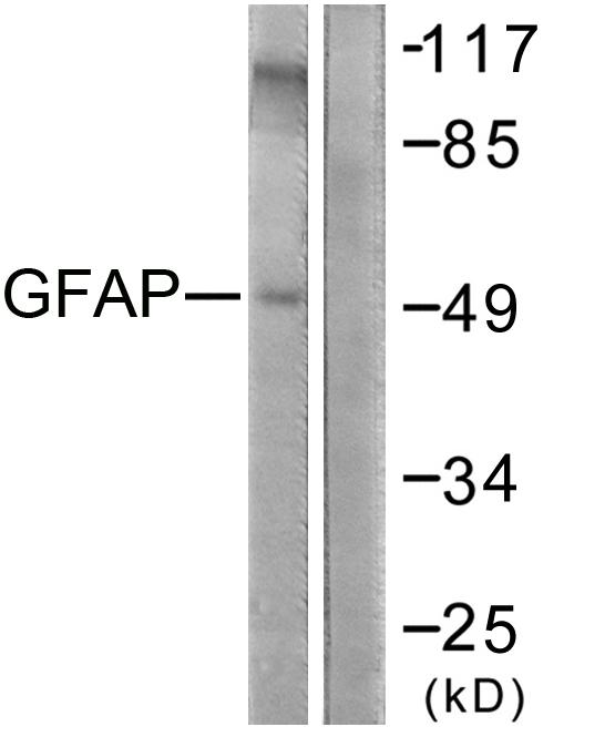 GFAP Antibody - Western blot analysis of lysates from COLO205 cells, using GFAP Antibody. The lane on the right is blocked with the synthesized peptide.
