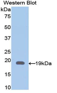 GFAP Antibody - Western blot of recombinant GFAP.  This image was taken for the unconjugated form of this product. Other forms have not been tested.