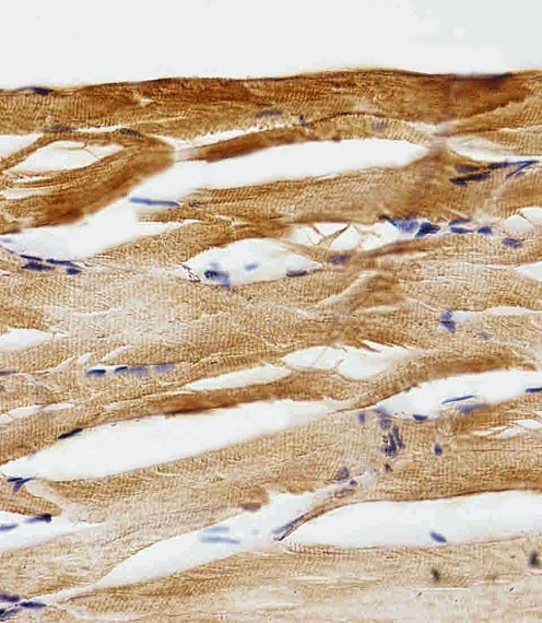 GFAP Antibody - Immunohistochemical of paraffin-embedded Z.muscle section using (DANRE) gfap Antibody. Antibody was diluted at 1:25 dilution. A peroxidase-conjugated goat anti-rabbit IgG at 1:400 dilution was used as the secondary antibody, followed by DAB staining.