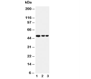 GFAP Antibody - Western blot testing of GFAP antibody and Lane 1: human U87 cell lysate; 2: mouse brain; 3: rat brain
