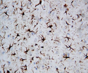 GFAP Antibody - IHC-P: GFAP antibody testing of rat brain tissue