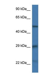 GFAP Antibody - GFAP antibody Western blot of Mouse Thymus lysate. Antibody concentration 1 ug/ml. This image was taken for the unconjugated form of this product. Other forms have not been tested.