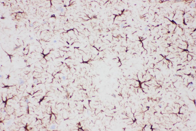 GFAP Antibody - GFAP antibody IHC-paraffin: Rat Brain Tissue.