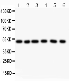 GFAP Antibody - Western blot analysis of GFAP using anti-GFAP antibody. Electrophoresis was performed on a 5-20% SDS-PAGE gel at 70V (Stacking gel) / 90V (Resolving gel) for 2-3 hours. The sample well of each lane was loaded with 50ug of sample under reducing conditions. Lane 1: Rat Brain Tissue Lysate Lane 2: Mouse Brain Tissue Lysate Lane 3: U87 Whole Cell Lysate Lane 4: SHG Whole Cell Lysate Lane 5: NEURO Whole Cell Lysate Lane 6: Hela Whole Cell Lysate After Electrophoresis, proteins were transferred to a Nitrocellulose membrane at 150mA for 50-90 minutes. Blocked the membrane with 5% Non-fat Milk/ TBS for 1.5 hour at RT. The membrane was incubated with rabbit anti-GFAP antigen affinity purified polyclonal antibody at 0.5 µg/mL overnight at 4°C, then washed with TBS-0.1% Tween 3 times with 5 minutes each and probed with a goat anti-rabbit IgG-HRP secondary antibody at a dilution of 1:10000 for 1.5 hour at RT. The signal is developed using an Enhanced Chemiluminescent detection (ECL) kit with Tanon 5200 system. A specific band was detected for GFAP at approximately 49KD. The expected band size for GFAP is at 49KD.