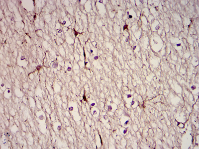 GFAP Antibody - IHC of paraffin-embedded brain tissues using GFAP mouse monoclonal antibody with DAB staining