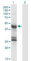 GFAP Antibody - Western Blot analysis of GFAP expression in transfected 293T cell line by GFAP monoclonal antibody (M06), clone 8H3.Lane 1: GFAP transfected lysate (Predicted MW: 49.9 KDa).Lane 2: Non-transfected lysate.