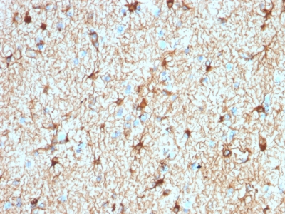 GFAP Antibody - Formalin-fixed, paraffin-embedded human Cerebellum stained with GFAP Rabbit Recombinant Monoclonal Antibody (ASTRO/1974R).