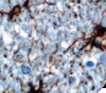 GFAP Antibody - IHC of GFAP on FFPE on a Brain tissue. This image was taken for the unmodified form of this product. Other forms have not been tested.