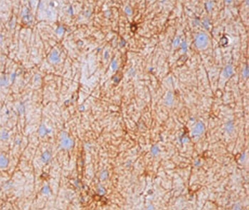 GFAP Antibody - IHC testing of human brain stained with GFAP antibody (GA-5). Note cytoplasmic staining.