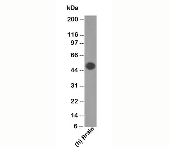 GFAP Antibody - GFAP antibody GA-5 western blot.  This image was taken for the unmodified form of this product. Other forms have not been tested.