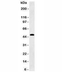 GFAP Antibody - Western blot testing of human brain and GFAP antibody (GFA12-3). Predicted molecular weight ~50 kDa.  This image was taken for the unmodified form of this product. Other forms have not been tested.