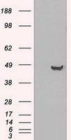 GFAP Antibody - HEK293T cells were transfected with the pCMV6-ENTRY control (Left lane) or pCMV6-ENTRY GFAP (Right lane) cDNA for 48 hrs and lysed. Equivalent amounts of cell lysates (5 ug per lane) were separated by SDS-PAGE and immunoblotted with anti-GFAP.