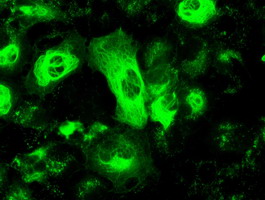 GFAP Antibody - Anti-GFAP mouse monoclonal antibody  immunofluorescent staining of COS7 cells transiently transfected by pCMV6-ENTRY GFAP.