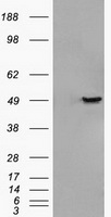 GFAP Antibody - HEK293T cells were transfected with the pCMV6-ENTRY control (Left lane) or pCMV6-ENTRY GFAP (Right lane) cDNA for 48 hrs and lysed. Equivalent amounts of cell lysates (5 ug per lane) were separated by SDS-PAGE and immunoblotted with anti-GFAP.