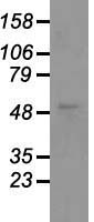 GFAP Antibody - Western blot analysis of 35ug of cell extracts from human Lung adenocarcinoma (A549) cells using anti-GFAP antibody.
