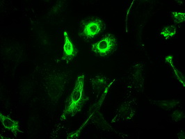 GFAP Antibody - Immunofluorescent staining of A549 cells using anti-GFAP mouse monoclonal antibody.
