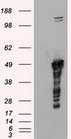 GFAP Antibody - HEK293T cells were transfected with the pCMV6-ENTRY control (Left lane) or pCMV6-ENTRY GFAP (Right lane) cDNA for 48 hrs and lysed. Equivalent amounts of cell lysates (5 ug per lane) were separated by SDS-PAGE and immunoblotted with anti-GFAP.