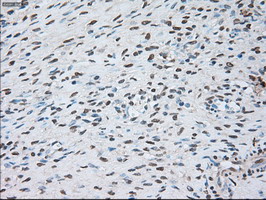 GFAP Antibody - IHC of paraffin-embedded Ovary tissue using anti-GFAP mouse monoclonal antibody. (Dilution 1:50).